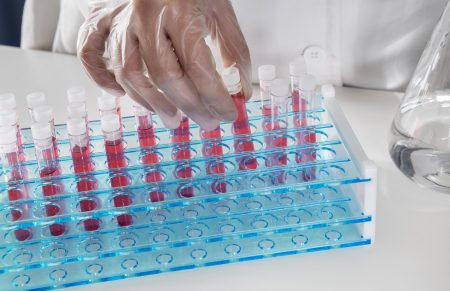 Escovas técnicas mantêm higienização eficiente de vidrarias em laboratórios