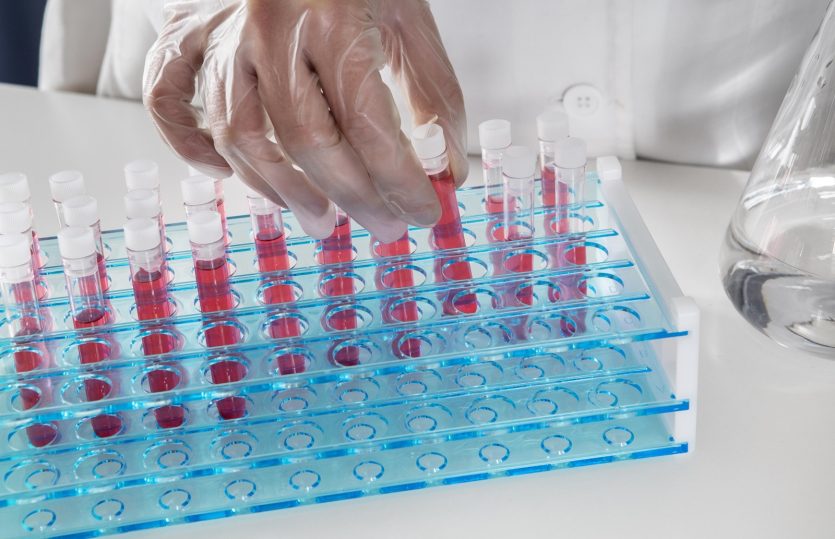 Escovas técnicas mantêm higienização eficiente de vidrarias em laboratórios